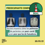 (Imagen) “Doctora muestra cómo los pulmones de pacientes post-Covid lucen peor que los de fumadores”: #Real