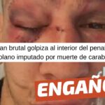 (Imagen) “Denuncian brutal golpiza al interior del penal Bío Bío a venezolano imputado por muerte de Carabinero”: #Engañoso